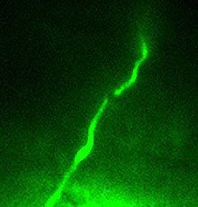 Photo: nerve axon cut